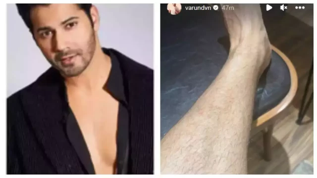 Varun Dhawan injured his leg while filming for an upcoming project, shares details on Instagram