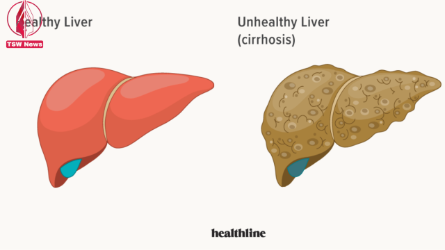 Liver Problems and Their Causes