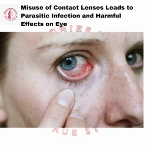 Misuse of Contact Lenses