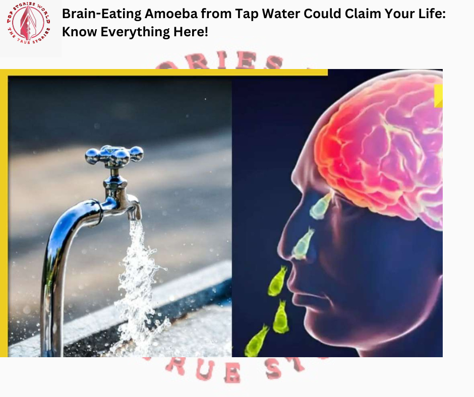 Brain-Eating Amoeba